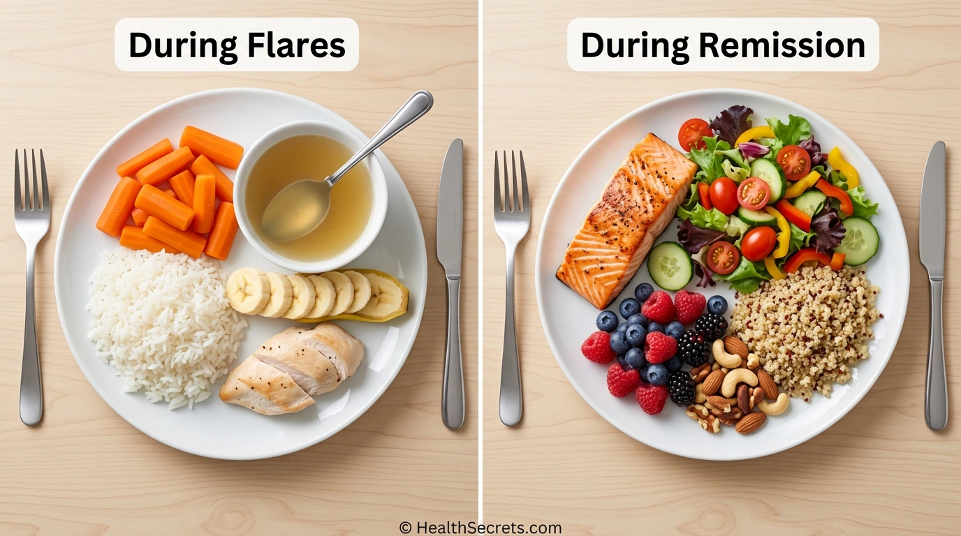 So sánh thực phẩm thân thiện với IBD cho thấy thực phẩm an toàn trong cơn bùng phát so với thực phẩm trong sự thuyên giảm